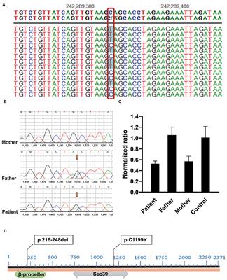 Case Report: Pediatric Recurrent Acute Liver Failure Caused by Neuroblastoma Amplified Sequence (NBAS) Gene Mutations